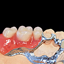 ウイロニウム®プラス