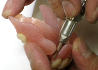 粘膜面の研磨１