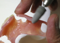 シリコンポイントなどで荒～中研磨を行います。