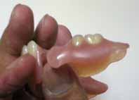 スルホンパットなどで面形状をきれいにします。