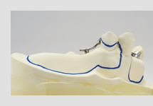 補足説明①(レスト下のクリアランス)