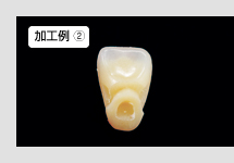 抜き方方法決定