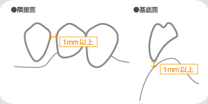 抜き方方法決定