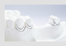 サベイヤー計測①