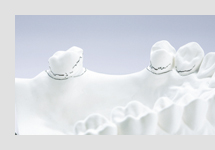 サベイヤー計測②