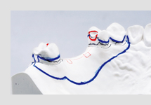 ブロックアウト・リリーフ・床外形線記入