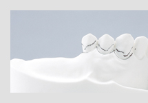 サベイヤー計測①