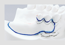 ブロックアウト・リリーフ・床外形線記入