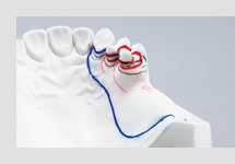 ブロックアウト・リリーフ・床外形線記入