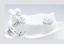 サベイヤー計測①