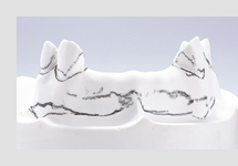 サベイヤー計測②