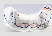 ブロックアウト・リリーフ・床外形線記入