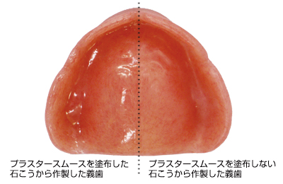 プラスタースムース使用義歯