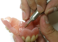 粘膜面の研磨２ 