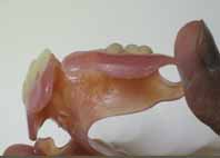 シリコンポイントなどで荒～中研磨を行います。