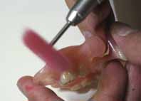 スルホンパットなどで面形状をきれいにします。