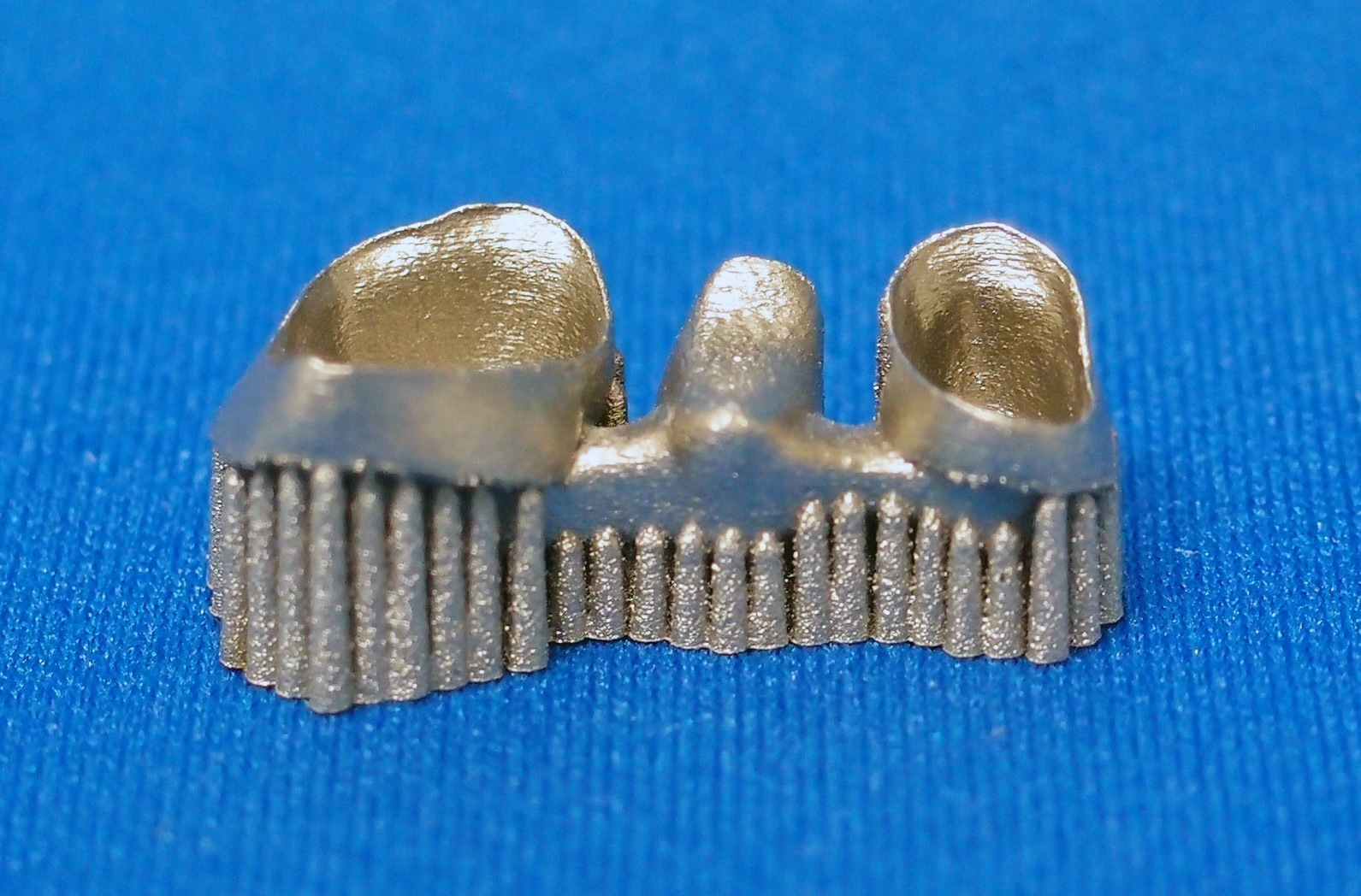 EOS社製EOSINT M270を用いた補綴物製作例

(和田精密社提供)