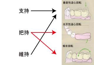 図2 義歯の動きと設計原則との関係