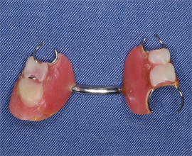 患者が以前使用していた義歯