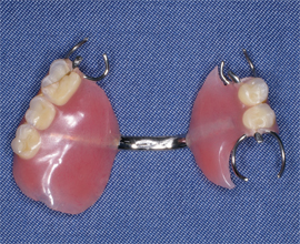 患者が以前使用していた義歯