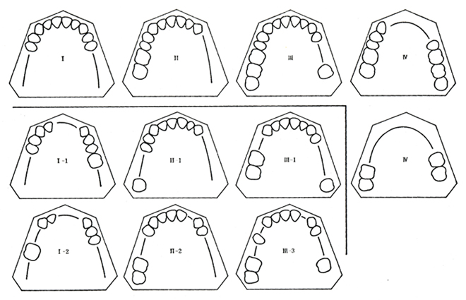 図2 Kennedyの分類